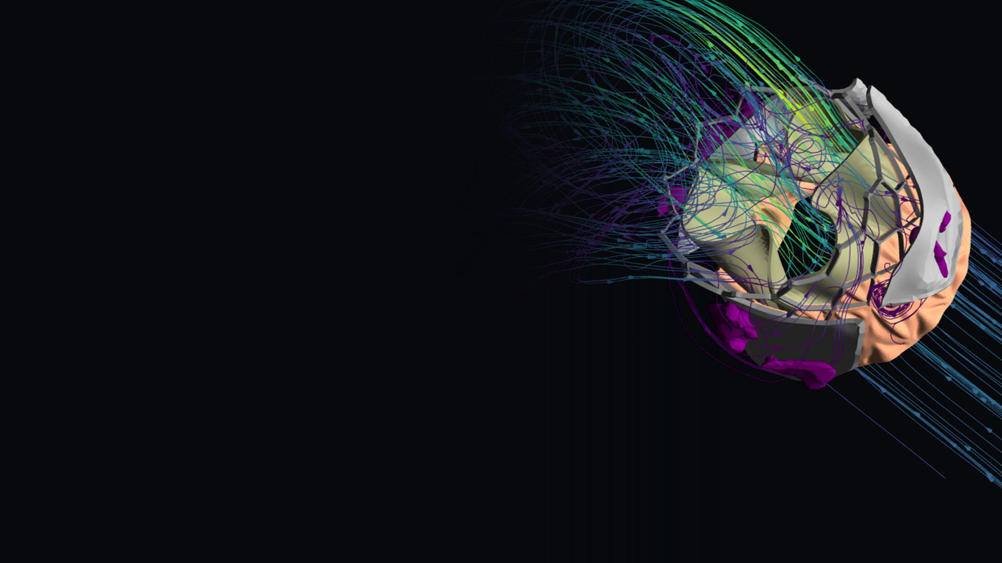 Heart-valve FSI visualization combining anatomical geometry and flow trajectories